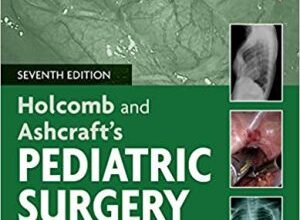 free-pdf-download-Holcomb and Ashcraft’s Pediatric Surgery 7th Edition