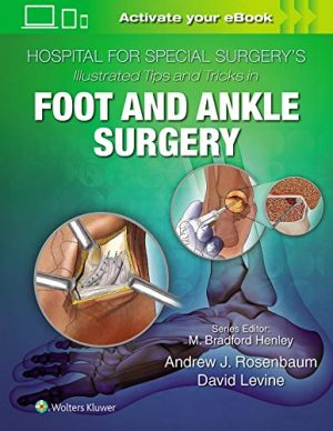 free-pdf-download-Hospital for Special Surgery’s Illustrated Tips and Tricks in Foot and Ankle Surgery