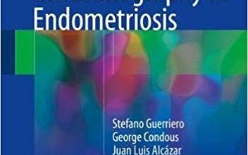 free-pdf-download-How to Perform Ultrasonography in Endometriosis 1st ed