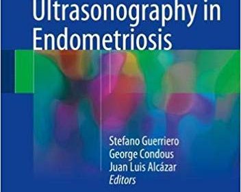 free-pdf-download-How to Perform Ultrasonography in Endometriosis 1st ed