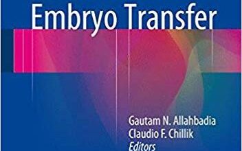 free-pdf-download-Human Embryo Transfer 1st ed