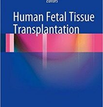 free-pdf-download-Human Fetal Tissue Transplantation