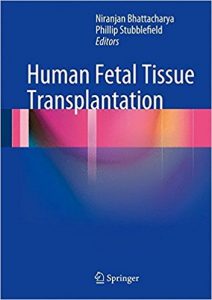 free-pdf-download-Human Fetal Tissue Transplantation