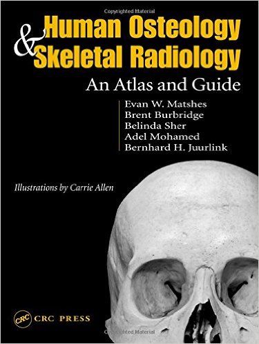 free-pdf-download-Human Osteology and Skeletal Radiology: An Atlas and Guide 1st Edition