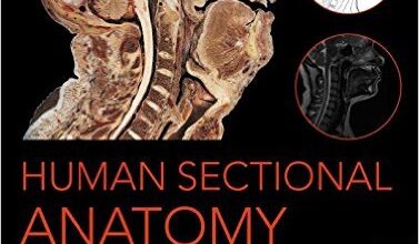 free-pdf-download-Human Sectional Anatomy: Atlas of Body Sections