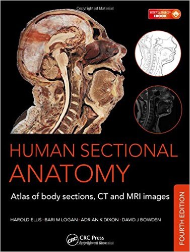 free-pdf-download-Human Sectional Anatomy: Atlas of Body Sections