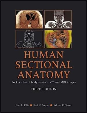 free-pdf-download-Human Sectional Anatomy Pocket Atlas of Body Sections