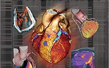 free-pdf-download-Hybrid Imaging in Cardiovascular Medicine (Imaging in Medical Diagnosis and Therapy) 1st Edition