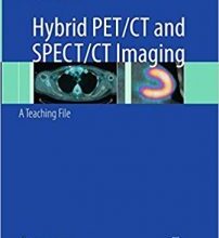 free-pdf-download-Hybrid PET/CT and SPECT/CT Imaging: A Teaching File