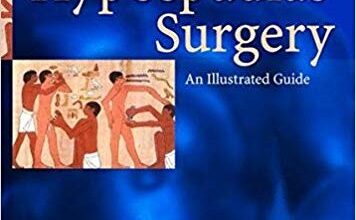 free-pdf-download-Hypospadias Surgery: An Illustrated Guide