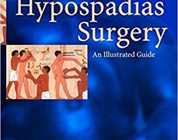 free-pdf-download-Hypospadias Surgery: An Illustrated Guide