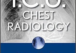 free-pdf-download-I.C.U. Chest Radiology: Principles and Case Studies Hardcover – 25 May 2010