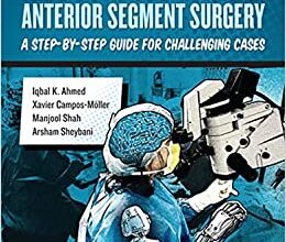 free-pdf-download-Illustrated Advanced Anterior Segment Surgery: A Step-by-Step Guide for Challenging Cases