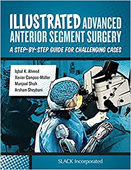 free-pdf-download-Illustrated Advanced Anterior Segment Surgery: A Step-by-Step Guide for Challenging Cases