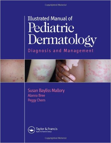 free-pdf-download-Illustrated Manual of Pediatric Dermatology: Diagnosis and Management