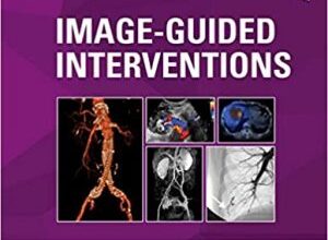 free-pdf-download-Image-Guided Interventions: Expert Radiology Series 3rd Edition