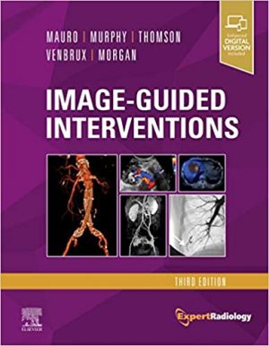 free-pdf-download-Image-Guided Interventions: Expert Radiology Series 3rd Edition