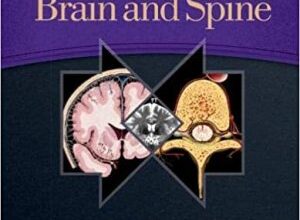 free-pdf-download-Imaging Anatomy Brain and Spine 1st Edition