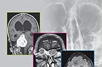 free-pdf-download-Imaging for Otolaryngologists 1st Edition