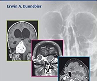 free-pdf-download-Imaging for Otolaryngologists 1st Edition