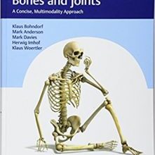 free-pdf-download-Imaging of Bones and Joints: A Concise