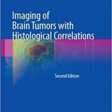 free-pdf-download-Imaging of Brain Tumors with Histological Correlations 2nd Edition