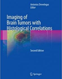 free-pdf-download-Imaging of Brain Tumors with Histological Correlations 2nd Edition