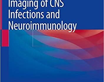 free-pdf-download-Imaging of CNS Infections and Neuroimmunology 1st ed