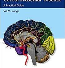 free-pdf-download-Imaging of Cerebrovascular Disease: A Practical Guide 1st Edition