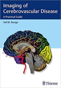 free-pdf-download-Imaging of Cerebrovascular Disease: A Practical Guide 1st Edition