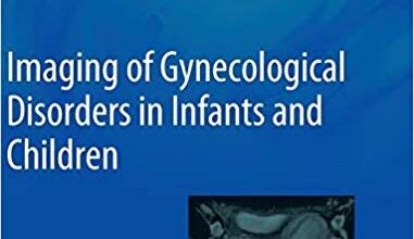 free-pdf-download-Imaging of Gynecological Disorders in Infants and Children (Medical Radiology)