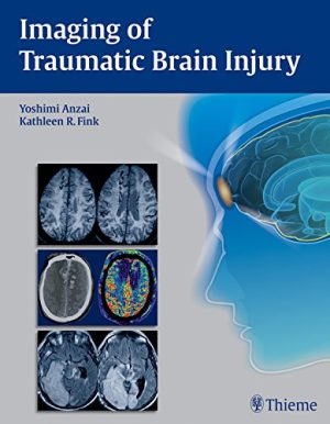 free-pdf-download-Imaging of Traumatic Brain Injury 1st Edition