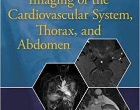 free-pdf-download-Imaging of the Cardiovascular System