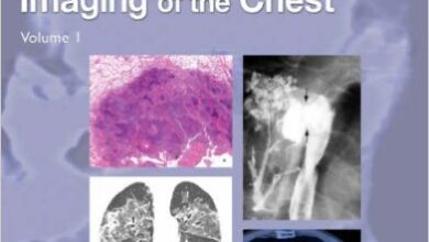 free-pdf-download-Imaging of the Chest