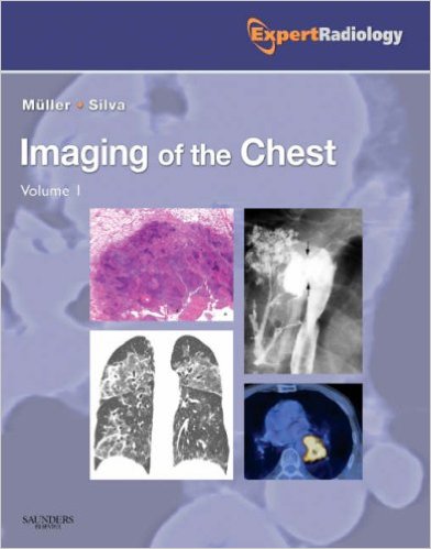 free-pdf-download-Imaging of the Chest