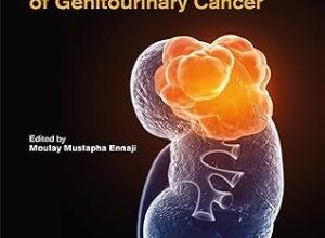 free-pdf-download-Immunological Implications and Molecular Diagnostics of Genitourinary Cancer