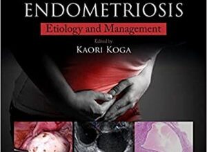 free-pdf-download-Immunology of Endometriosis: Pathogenesis and Management