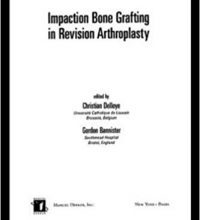 free-pdf-download-Impaction Bone Grafting in Revision Arthroplasty 1st Edition