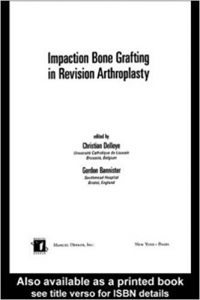 free-pdf-download-Impaction Bone Grafting in Revision Arthroplasty 1st Edition