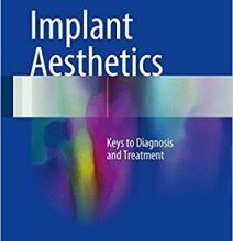 free-pdf-download-Implant Aesthetics: Keys to Diagnosis and Treatment 1st ed. 2017 Edition