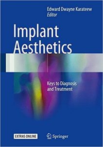 free-pdf-download-Implant Aesthetics: Keys to Diagnosis and Treatment 1st ed. 2017 Edition