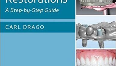 free-pdf-download-Implant Restorations: A Step-by-Step Guide