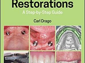 free-pdf-download-Implant Restorations: A Step-by-Step Guide 4th Edition