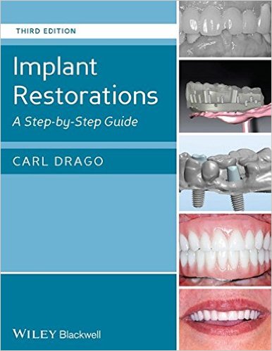 free-pdf-download-Implant Restorations: A Step-by-Step Guide