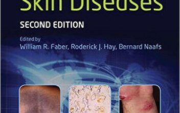 free-pdf-download-Imported Skin Diseases 2nd Edition