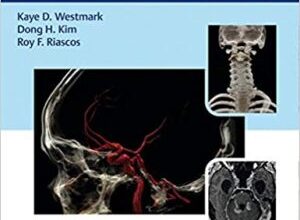 free-pdf-download-Incidental Findings in Neuroimaging and Their Management