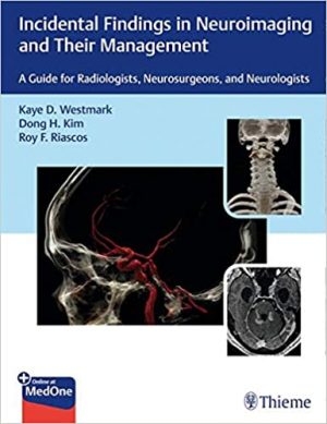 free-pdf-download-Incidental Findings in Neuroimaging and Their Management