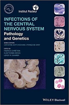 free-pdf-download-Infections of the Central Nervous System: Pathology and Genetics