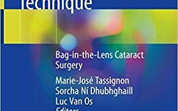 free-pdf-download-Innovative Implantation Technique: Bag-in-the-Lens Cataract Surgery 1st ed