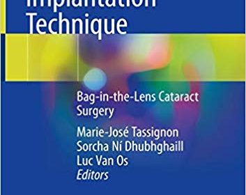 free-pdf-download-Innovative Implantation Technique: Bag-in-the-Lens Cataract Surgery 1st ed